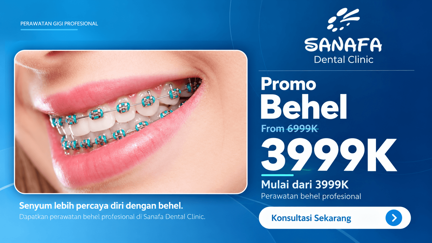 Promo Behel Sanafa Dental Clinic mulai Rp3.999.000, dengan foto perawatan behel.
